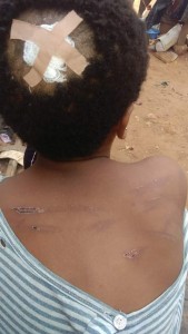 A young maid identified as Kaosisochukwu is battling with an injury allegedly inflicted on her head by her madam because she allegedly failed to give her child afternoon pap.