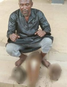 Police Arrest Suspected Ritualist Who Specialize In Buying And Selling Human Parts In Kwara