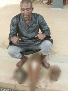 Suspected Ritualist Who Specialize In Buying And Selling Human Parts Arrested In Kwara