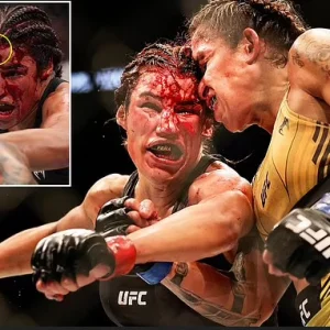 Female UFC Fighter, Julianna Pena Is Rushed To Hospital And Taken To See A Plastic Surgeon After Losing A ‘Big Chunk’ Of Her Forehead During Brutal Fight (Photos)