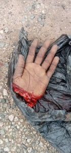 Nasarawa Man Chops Off Opponent's Wrist For Assaulting His Girlfriend