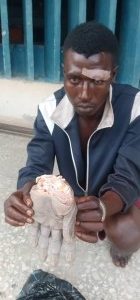 Nasarawa Man Chops Off Opponent's Wrist For Assaulting His Girlfriend