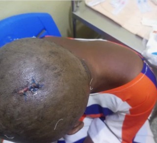 Ghanaian man attacks his fiancée with hammer over cheating allegations